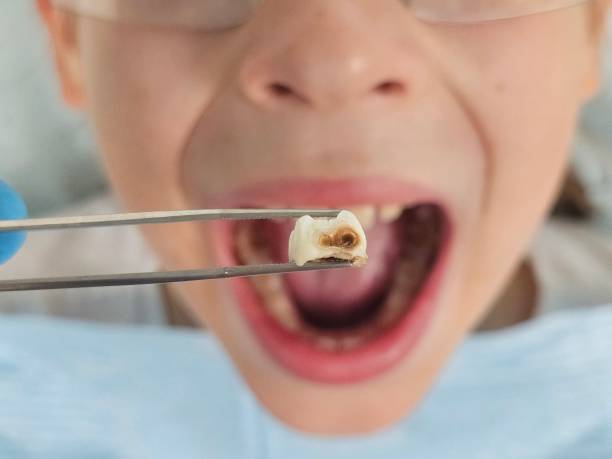 Best Emergency Pediatric Dental Care in Greenfield, MN